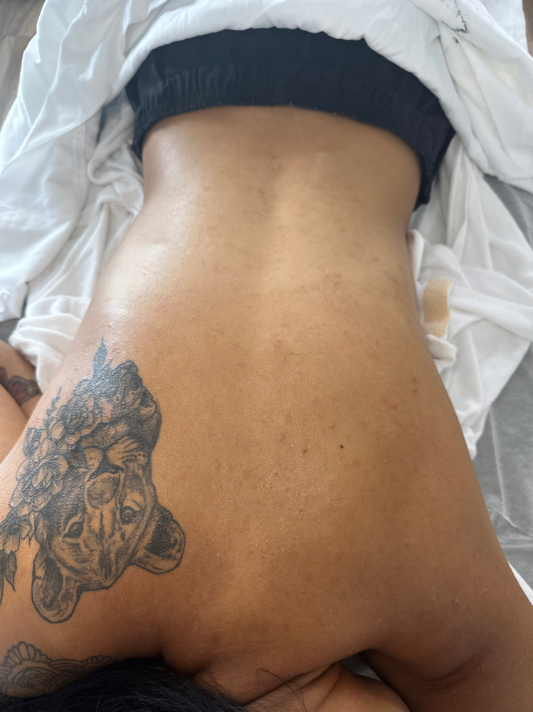 Back Facial