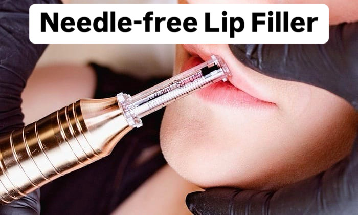 Lip Filler (Needle-free)