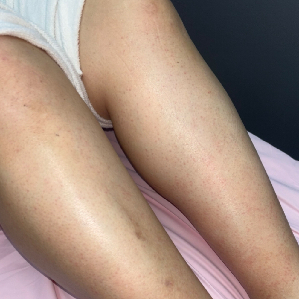 Leg Wax at skinXbeauty By Syd in Fort Payne, AL