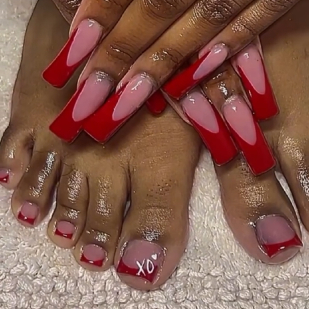nails fill + FUNGUS toes combo ♡ at NailsByChachiis in Colton, CA
