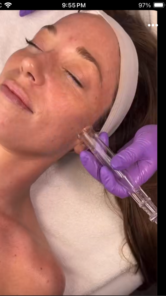 Lymphatic Service (Facial and Neck)