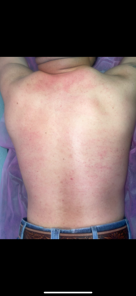 Full front & back wax