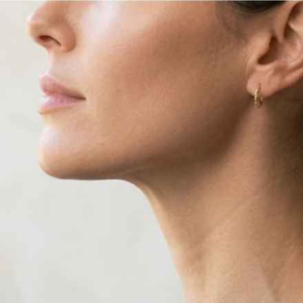 Kybella Injections at JENNVIE Med Spa in Westport, CT