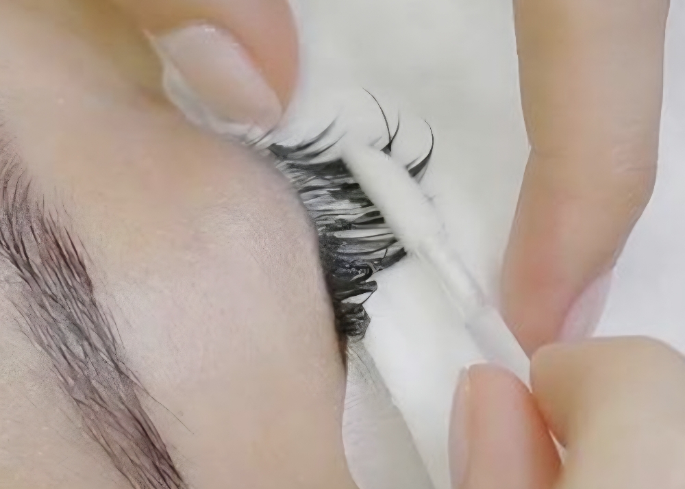 Eyelash Extensions Removal