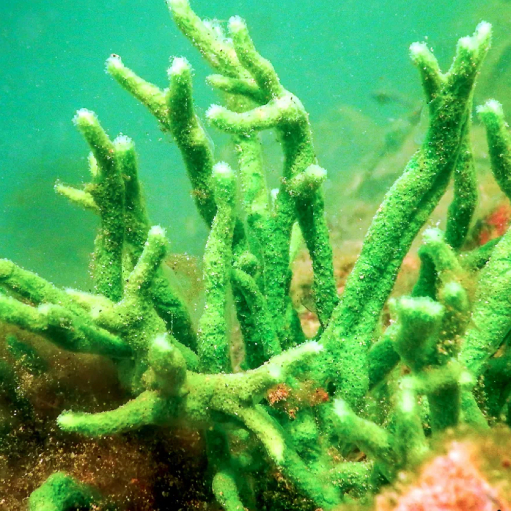 Green Sea Peel consultation at Daylex Spa in Storm Lake, IA