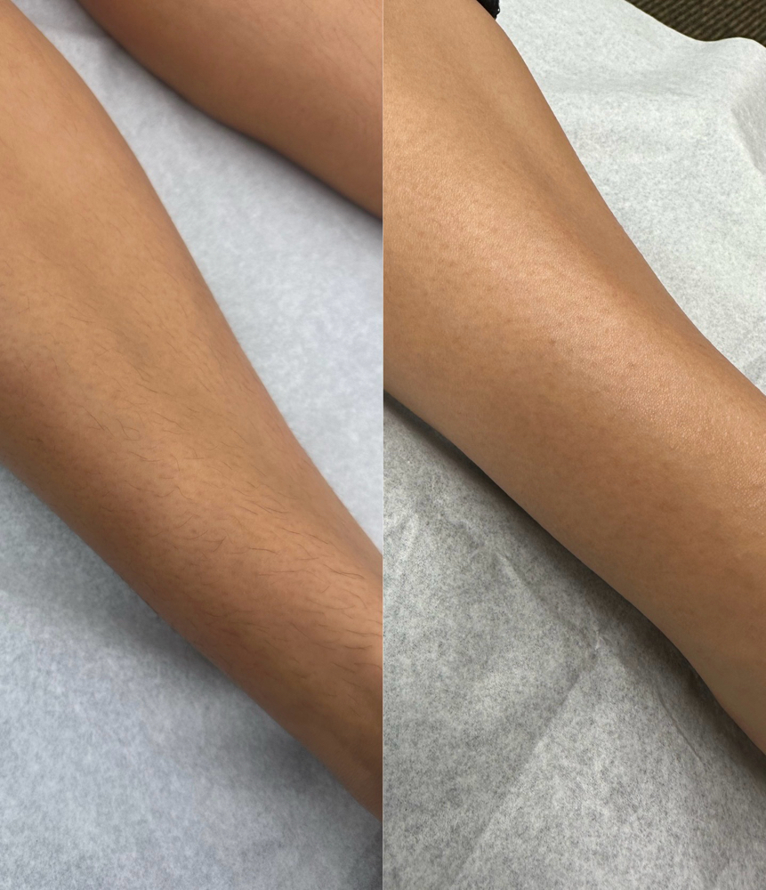 Half Leg Wax