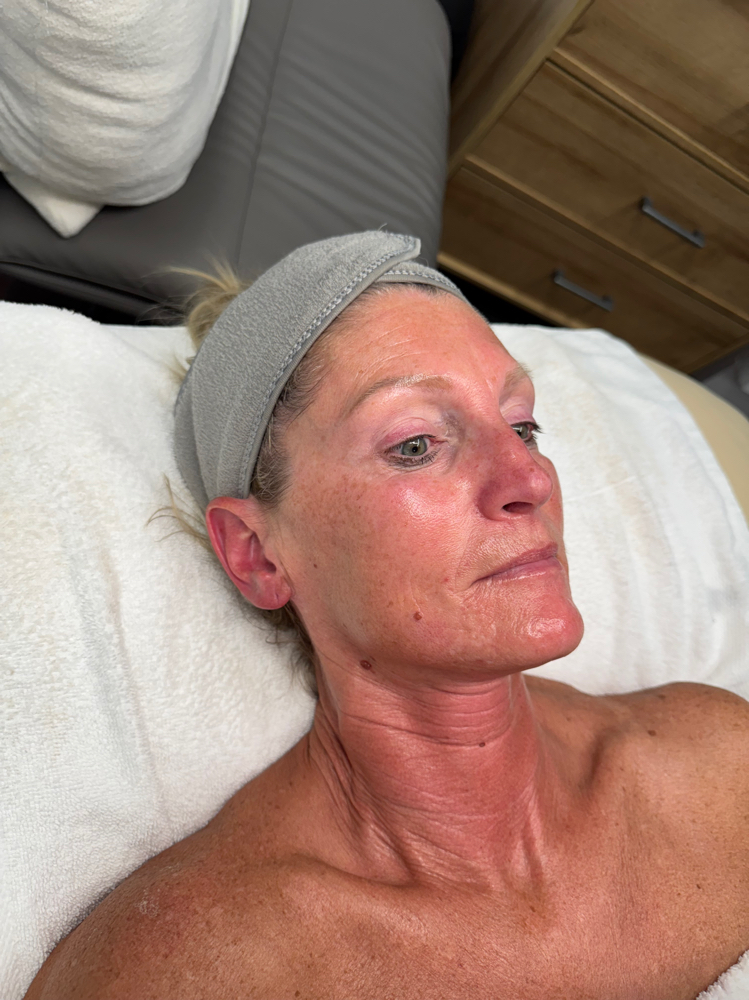 Swich Facial