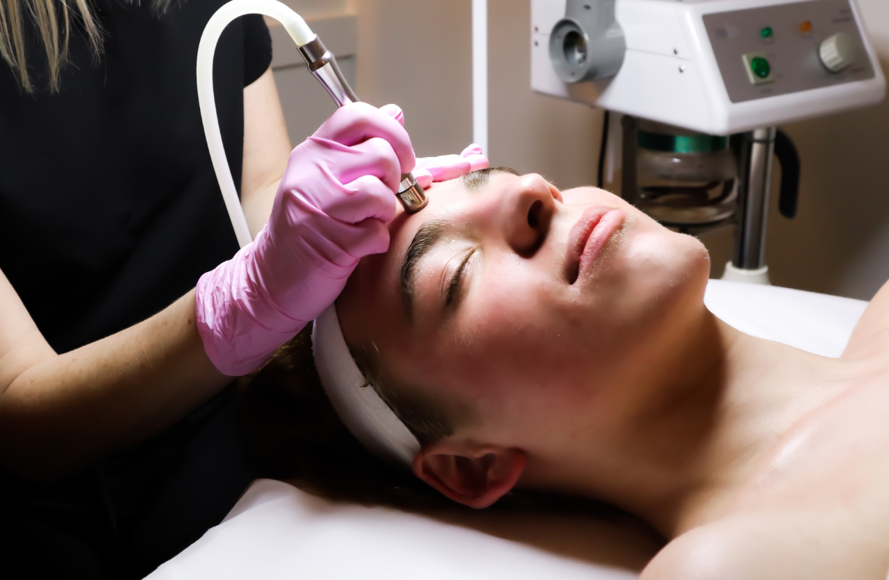 Microdermabrasion