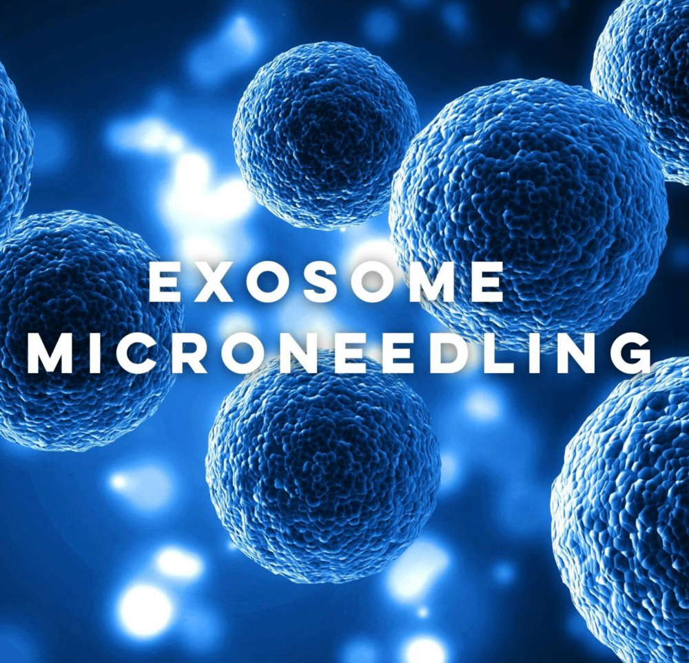 🧬 Exosome Microneedling