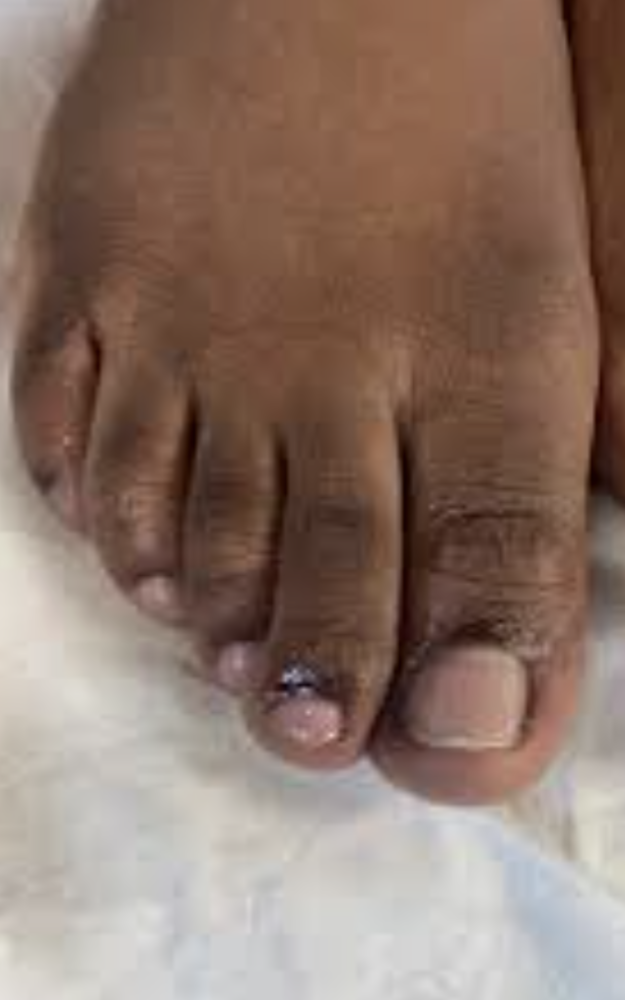 Testosterone Toes