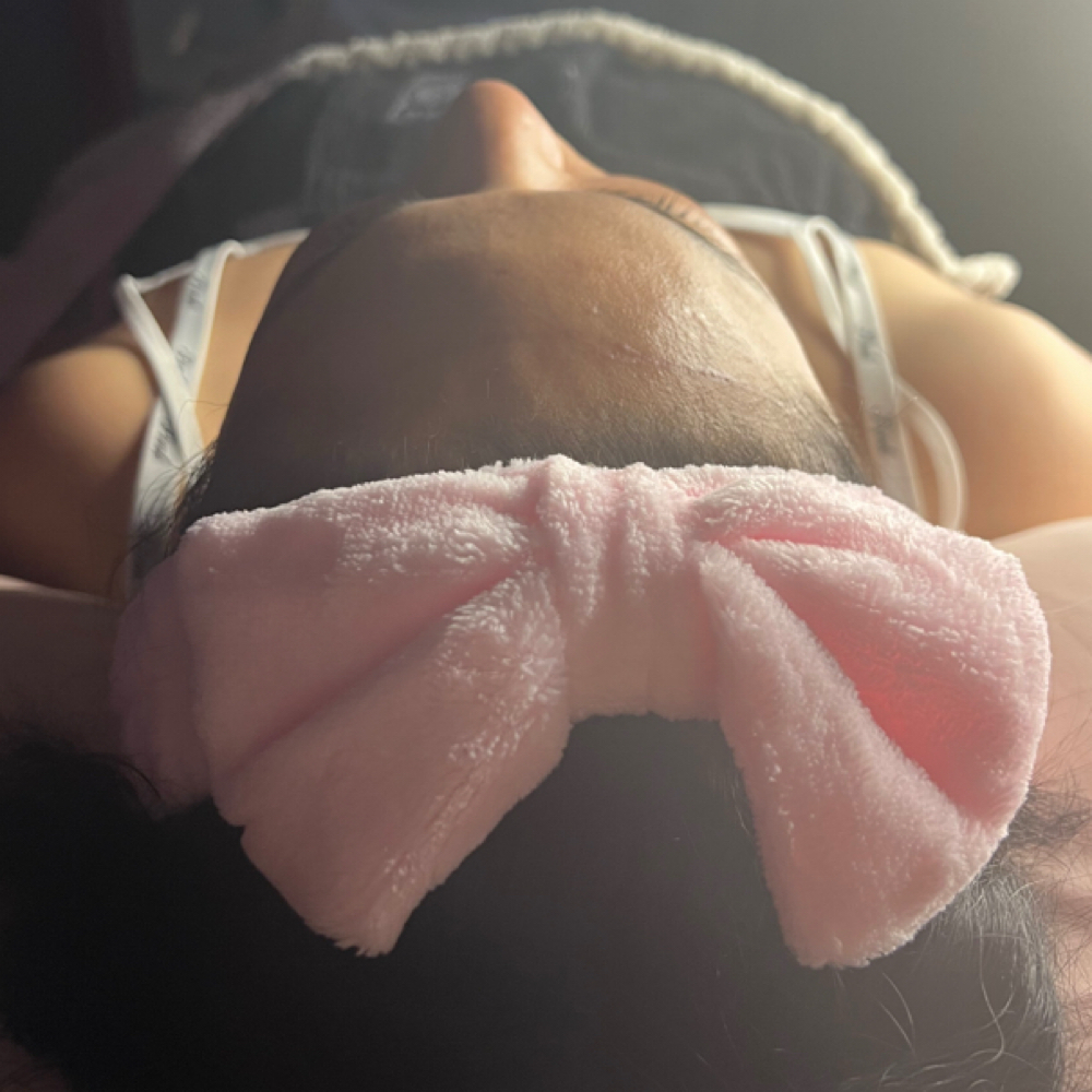 Chemical peel at Pure Bliss Studios in Fort worth, TX