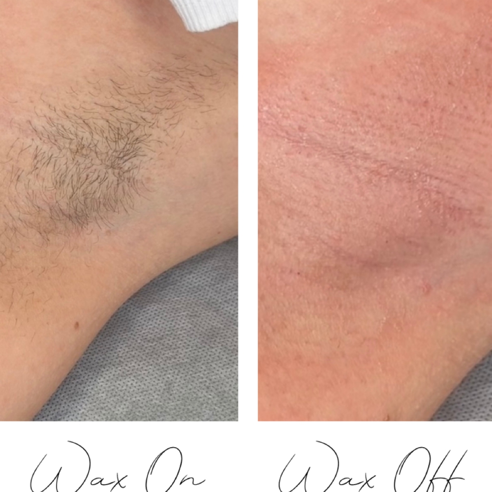 Deluxe Brazilian & Underarm Combo at It's Aesthetically Jess in Swansea, IL