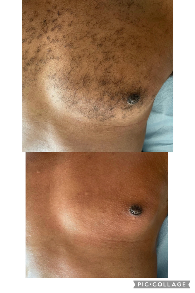 Chest / Shoulder Wax