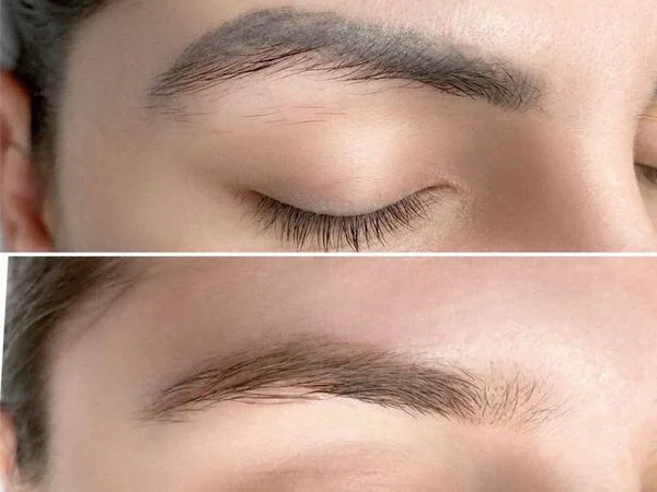 Remove Old Eyebrows - Non Laser