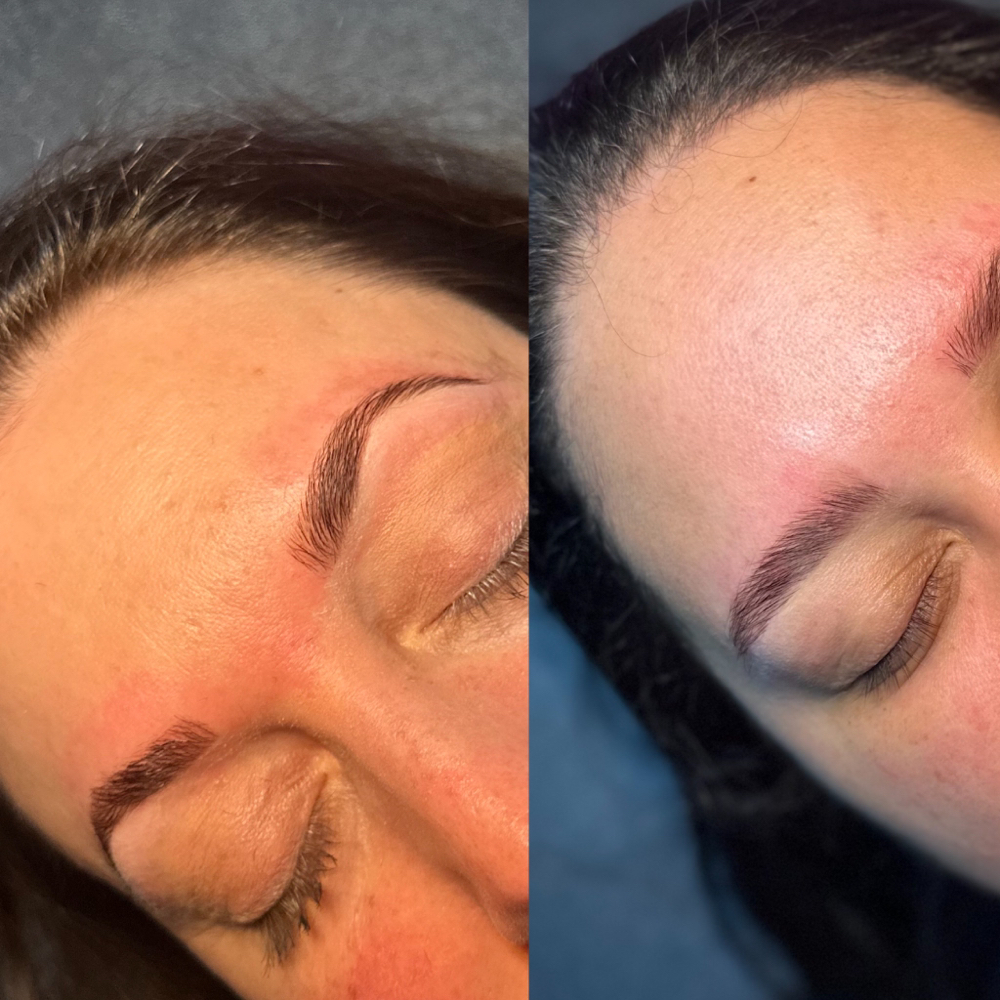 The Brow Package