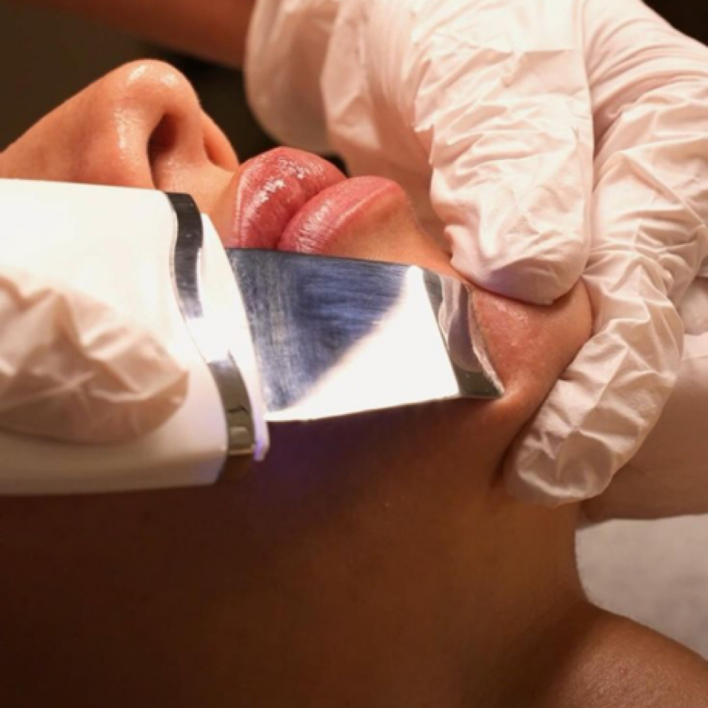 Extractions at Lassai Esthetics in Lanham, MD