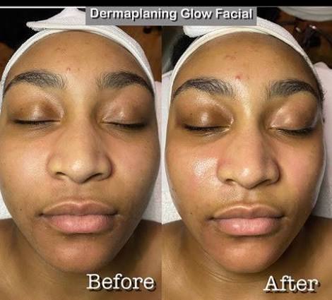 Her. Signature Dermaplaning Facial