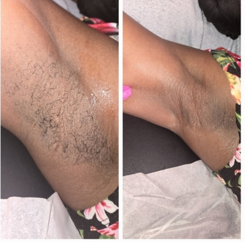 Armpit Waxing