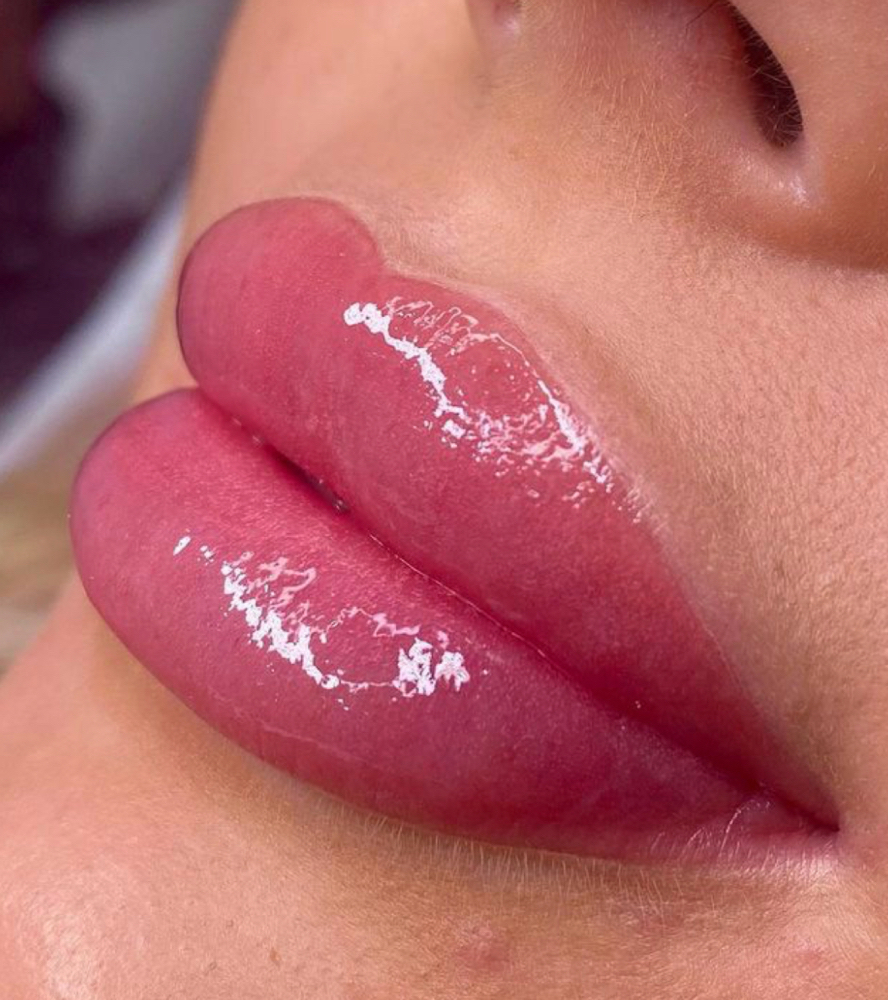Lip Touch Up (2nd Session)