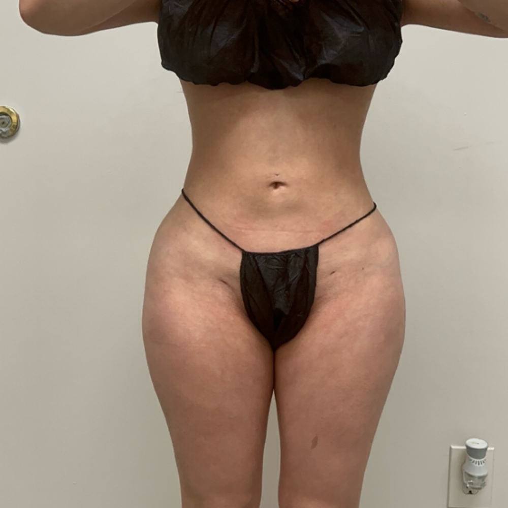 Single Full Body lymphatic with red light at Beauty And Body in San Dimas, CA