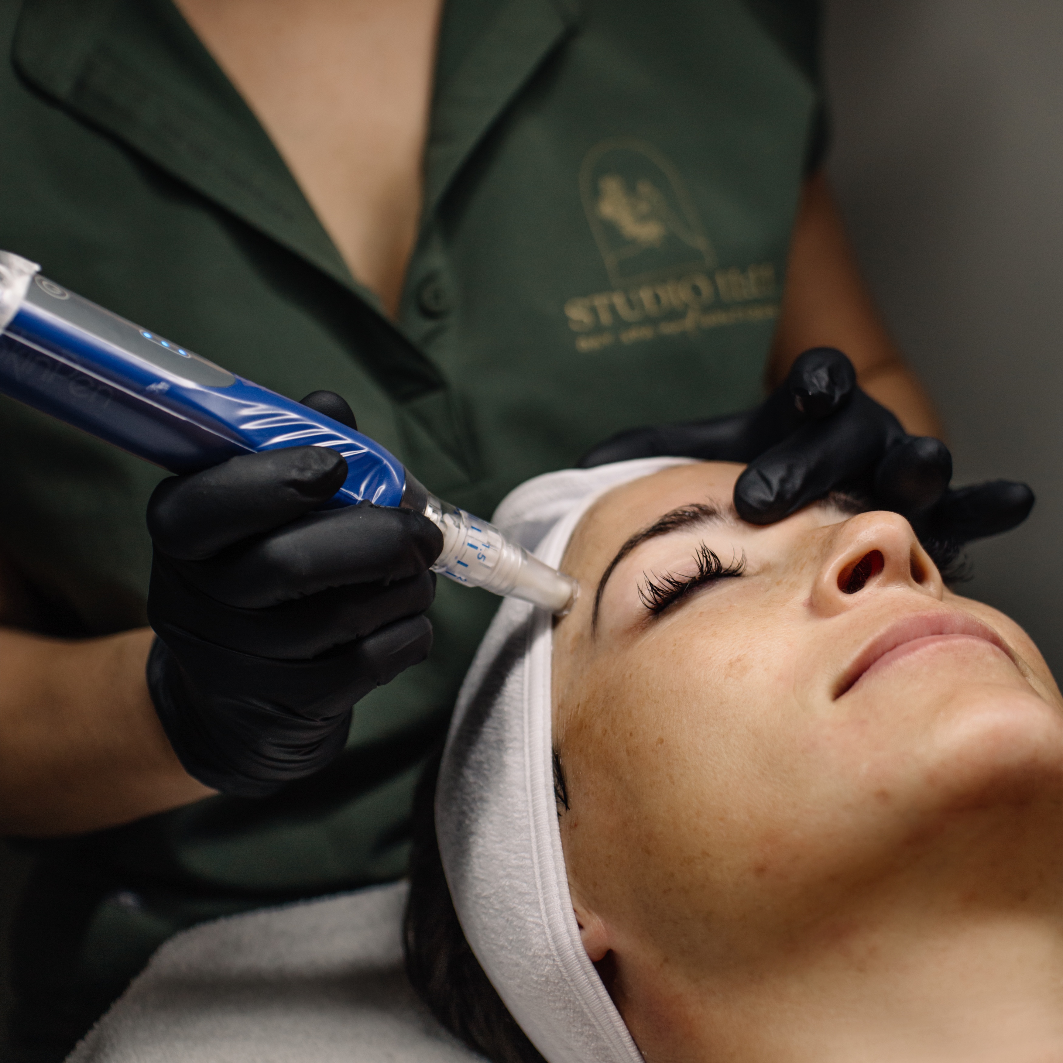 SkinPen Microneedling + Exsosomes at Studio Eleven Eleven Day Spa & Boutique in Sebastian, FL