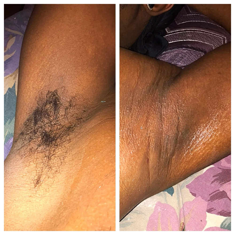 Underarms Wax
