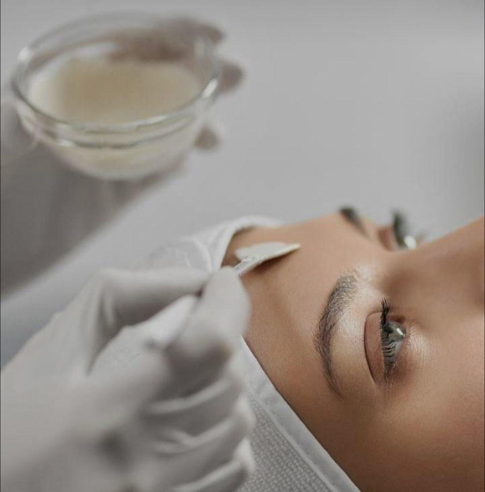 Chemical Peel- ADD ON at Esthetics with Ali in Burleson, TX
