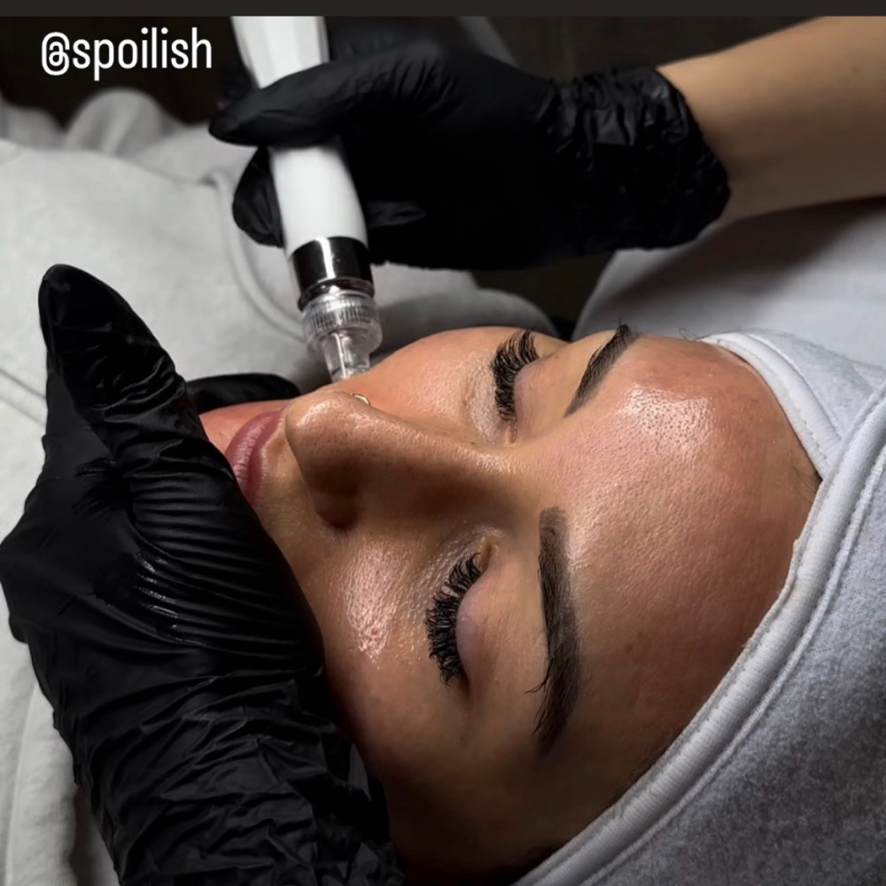 Hydra Facial at Spoilish in Santa Clarita, CA