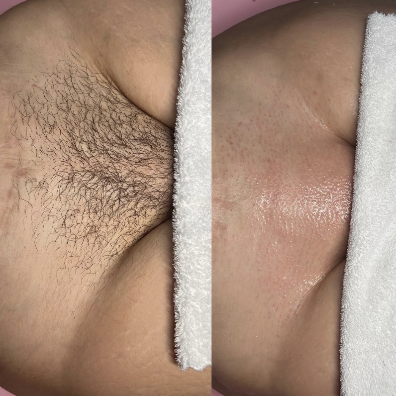 Brazilian Wax at True Beauty LLC in Hobart, IN
