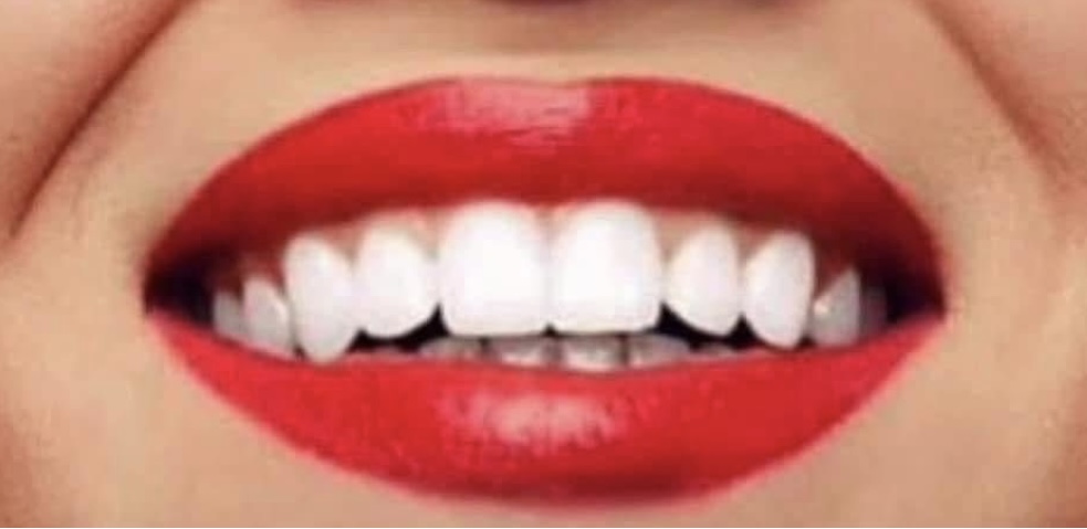Deluxe Whitening