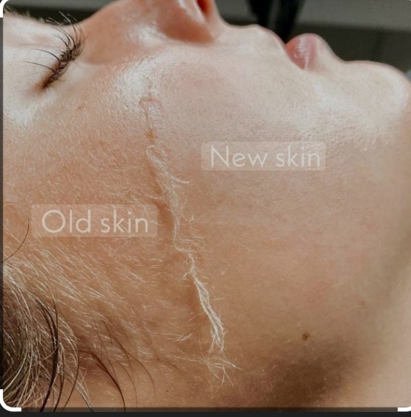 Signature NTK Glow Facial at Not That Karen Esthetics in Tulsa, OK