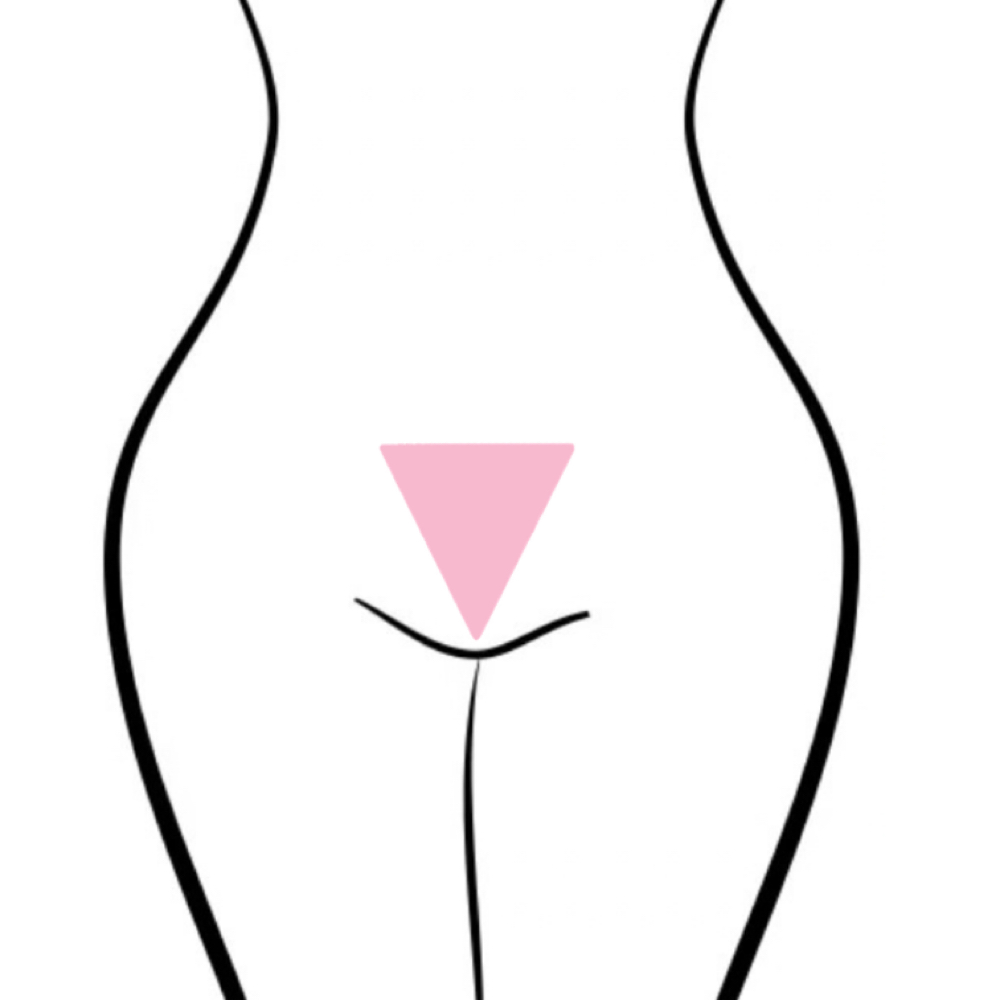 Thong Bikini (No Labia) at Body by Evelyn in Seattle, WA