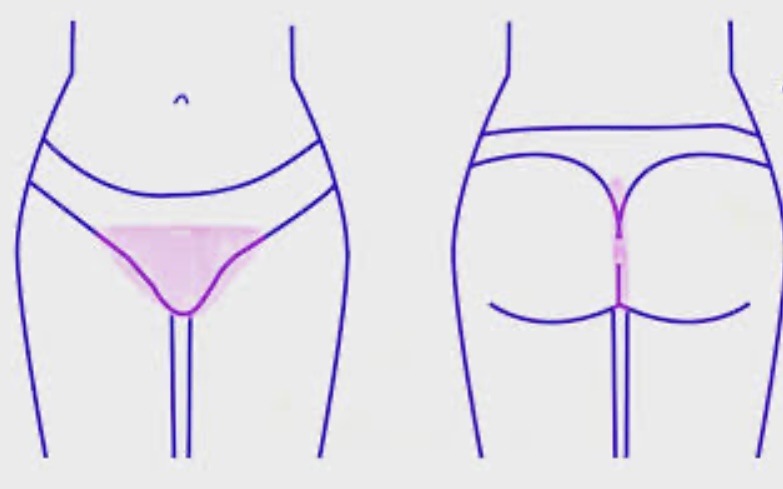 Brazilian Wax (V)