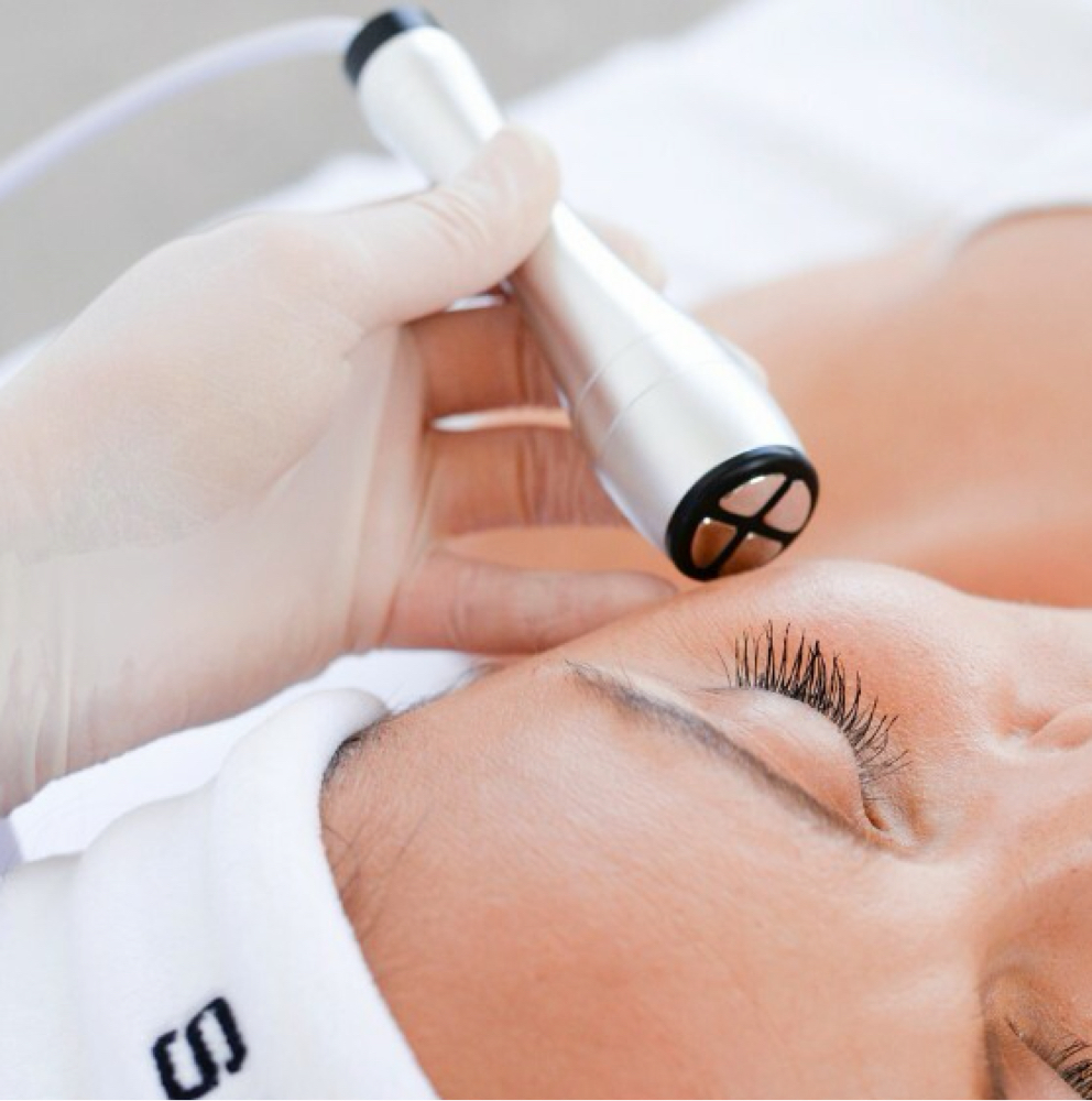 RF Skin Tightening at Cora Esthetics in Lubbock, TX