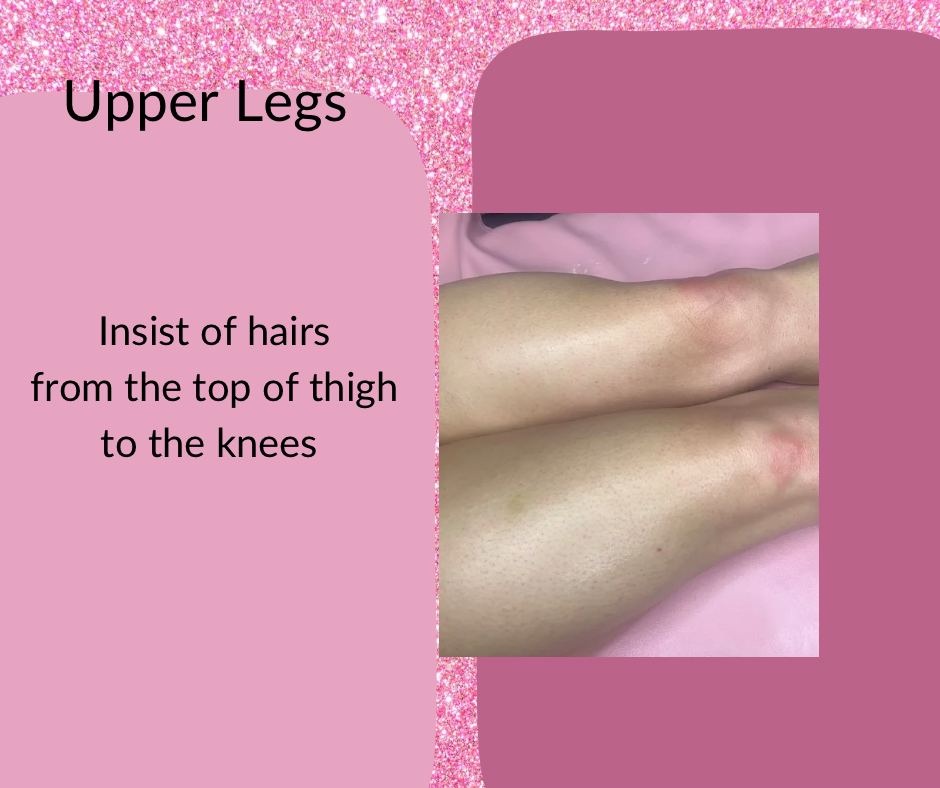 Upper Legs