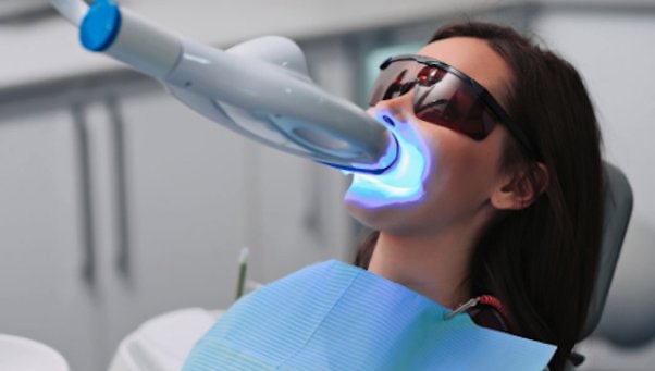 Teeth Whitening at Southern Tease Salon & Spa in Leesville, LA