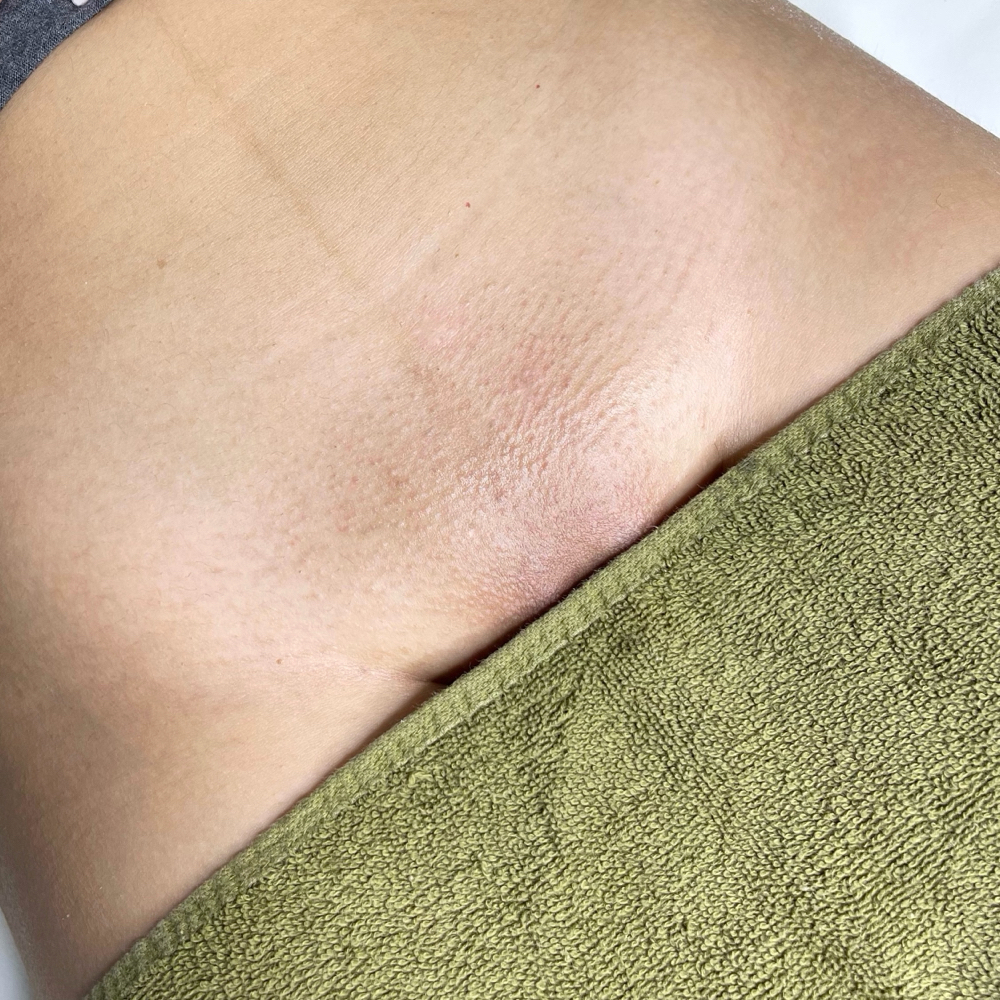 BRAZILIAN WAX at Czerinaesthetics, LLC in San Antonio, TX