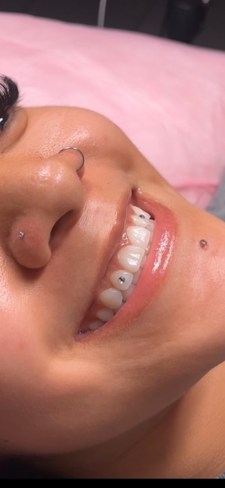Tooth Gems