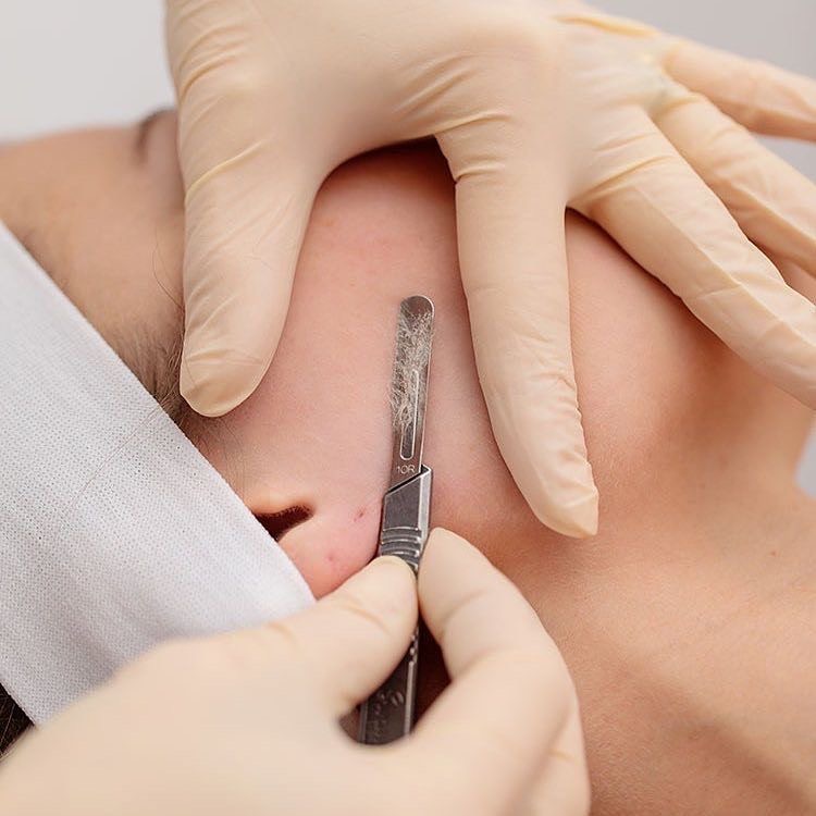 Deluxe Dermaplaning Experience