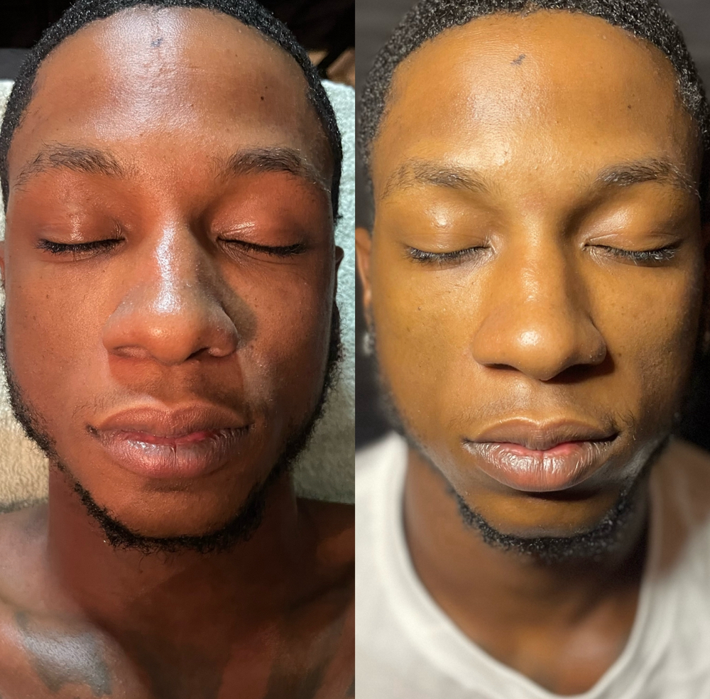 Gentlemens facial