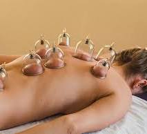 Therapeutic Massage and Cupping