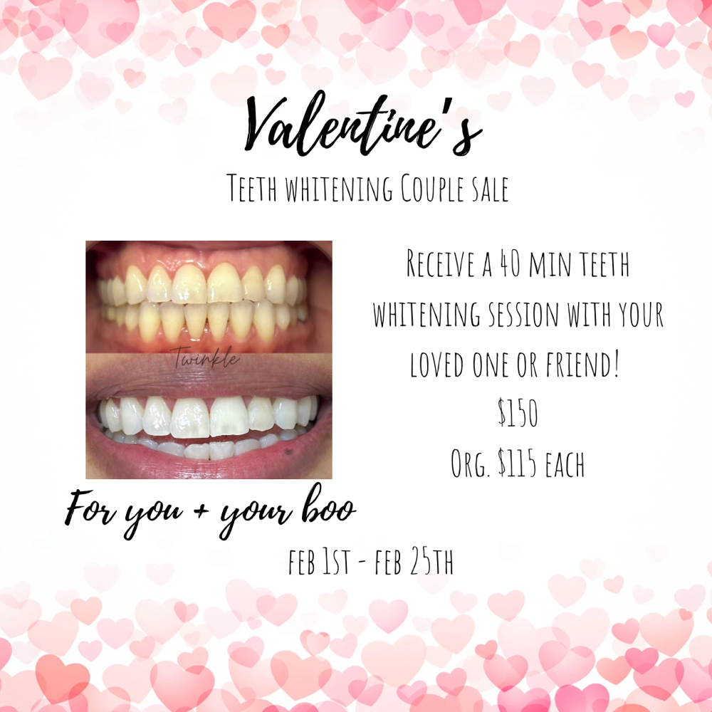 V- Day Teeth Whitening Duo Special