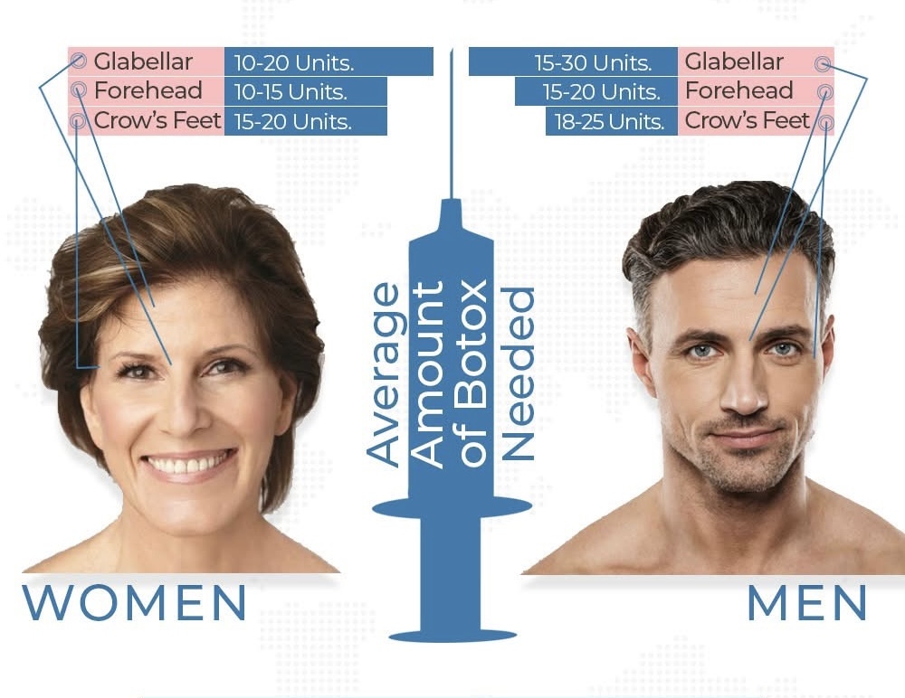 Botox