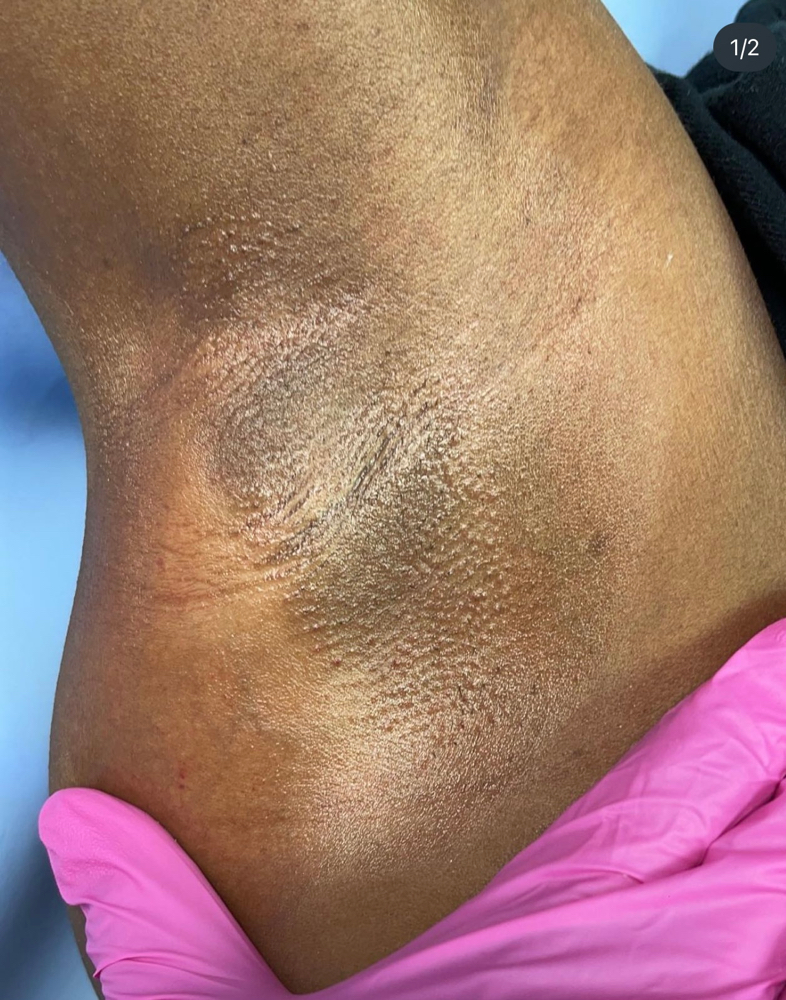 Underarm Wax
