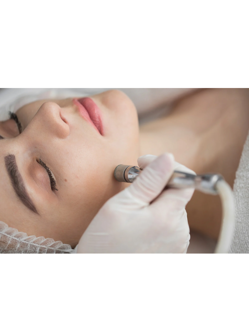 Facials - Microdermabrasion