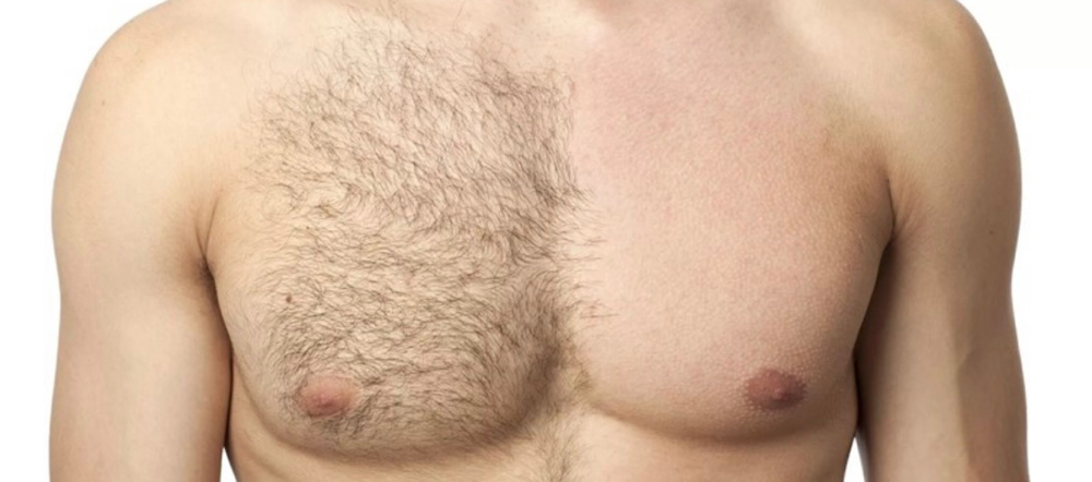Chest Wax