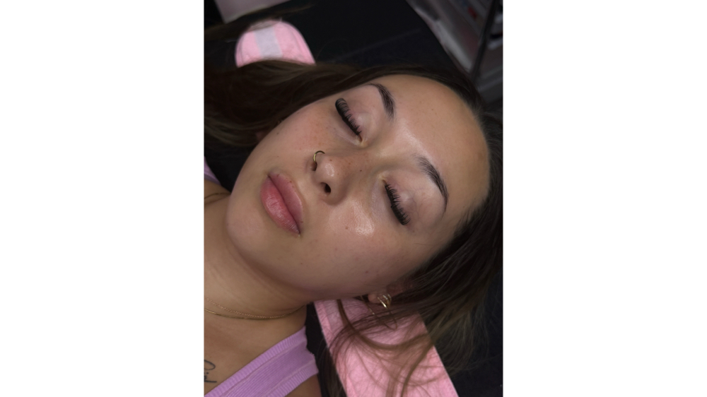 Dermaplane Facial