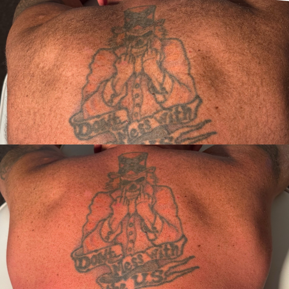 BACK (M)