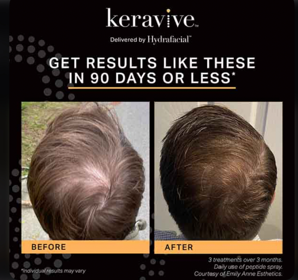 360 Scalp & Hair Renewal
