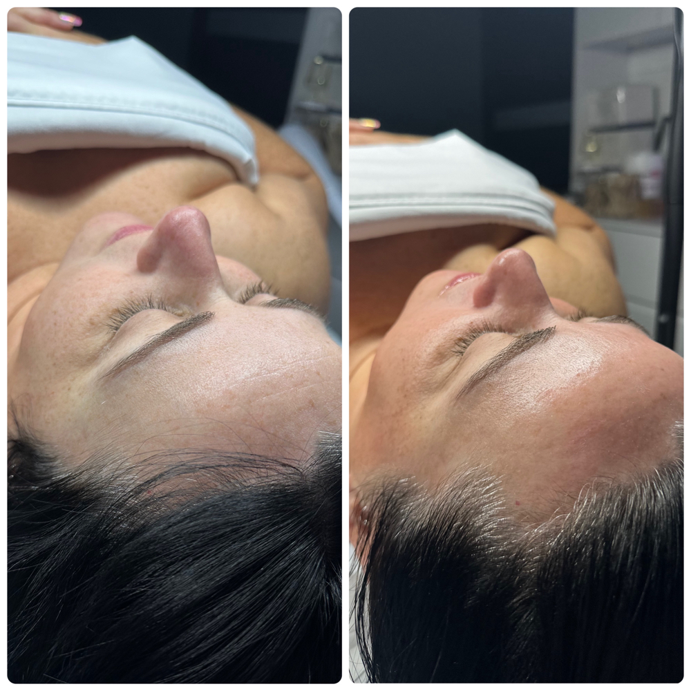 GLOW Customized Facial